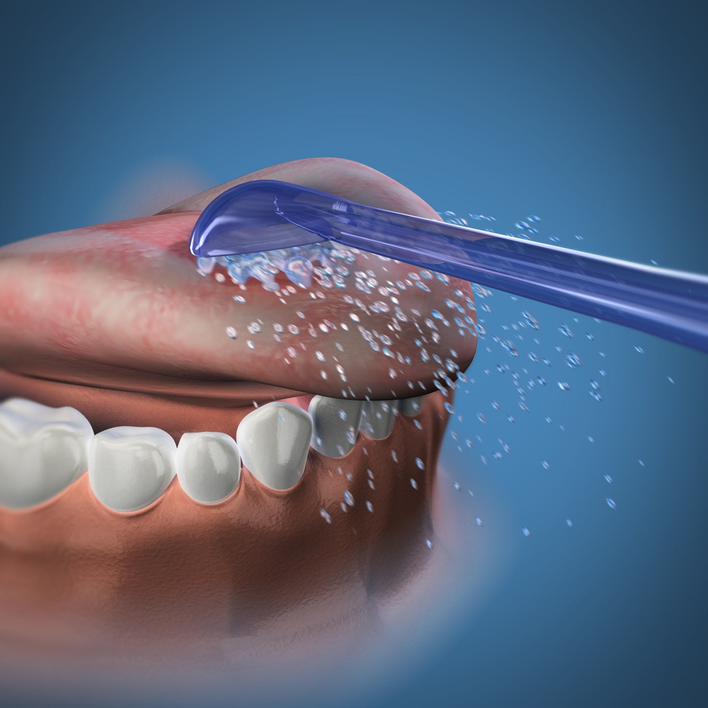 Tips (2 pc) - Tongue Cleaner Tip